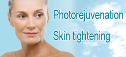 photorejuvenation with skin tightening