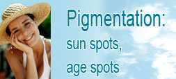 removal of pigmentation by laser